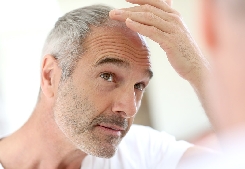 6 tips to reduce hair loss